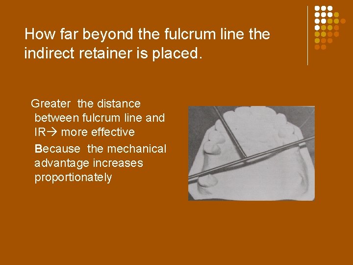 How far beyond the fulcrum line the indirect retainer is placed. Greater the distance