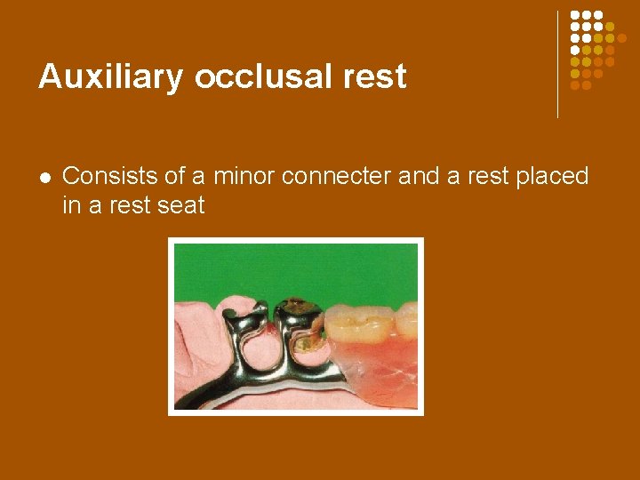 Auxiliary occlusal rest l Consists of a minor connecter and a rest placed in