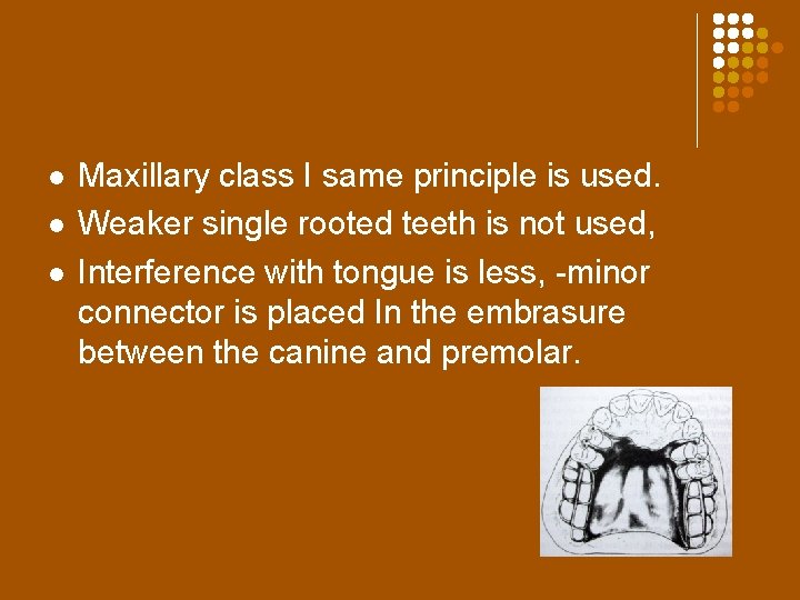 l l l Maxillary class I same principle is used. Weaker single rooted teeth