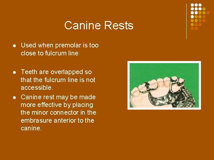 Canine Rests l Used when premolar is too close to fulcrum line l Teeth