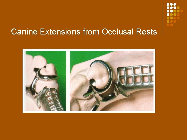 Canine Extensions from Occlusal Rests 