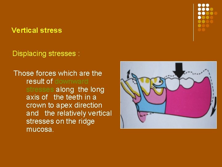 Vertical stress Displacing stresses : Those forces which are the result of downward stresses