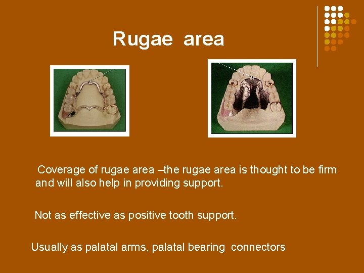 Rugae area Coverage of rugae area –the rugae area is thought to be firm