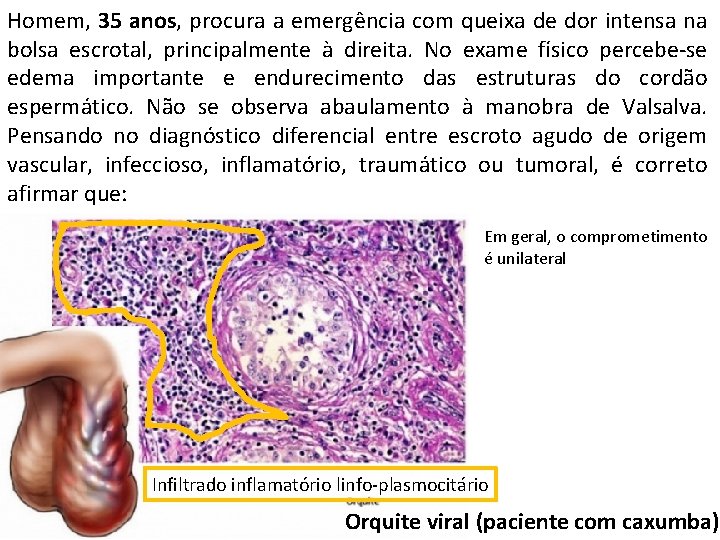 Homem, 35 anos, procura a emergência com queixa de dor intensa na bolsa escrotal,