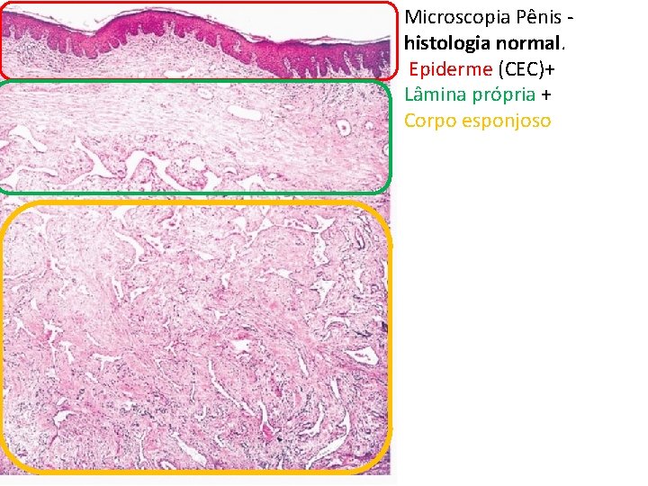 Microscopia Pênis - histologia normal. Epiderme (CEC)+ Lâmina própria + Corpo esponjoso 