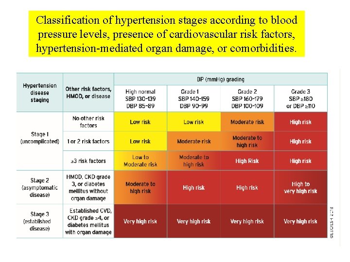 Classification of hypertension stages according to blood pressure levels, presence of cardiovascular risk factors,