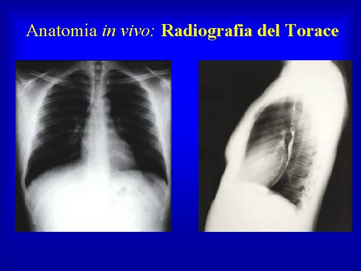 Anatomia in vivo: Radiografia del Torace 