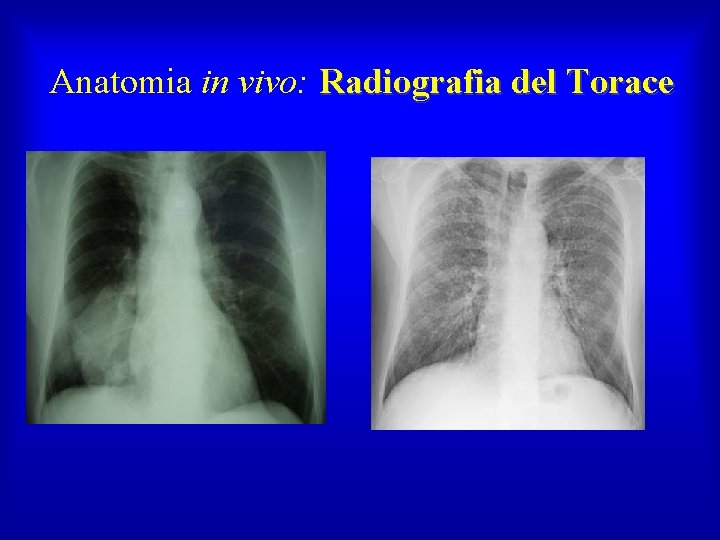 Anatomia in vivo: Radiografia del Torace 