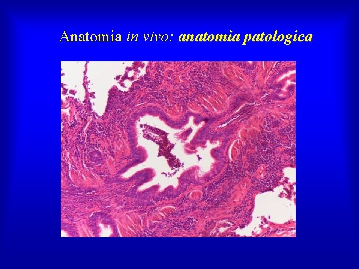 Anatomia in vivo: anatomia patologica 