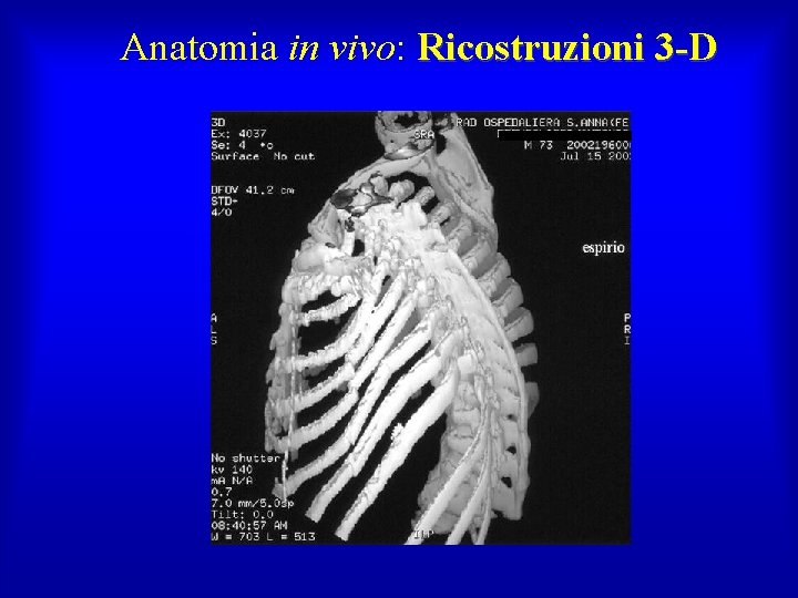 Anatomia in vivo: Ricostruzioni 3 -D 