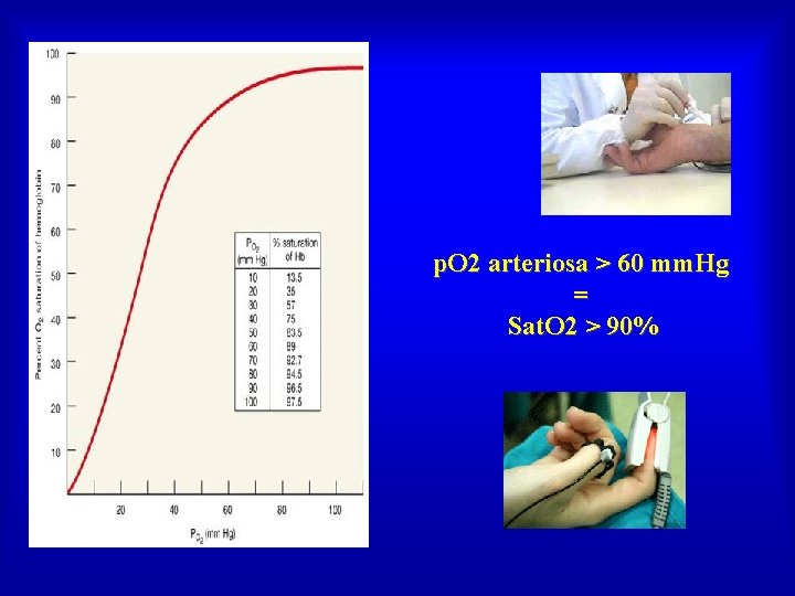 p. O 2 arteriosa > 60 mm. Hg = Sat. O 2 > 90%