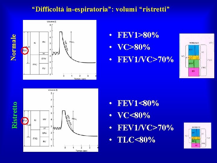 Ristretto Normale “Difficoltà in-espiratoria”: volumi “ristretti” • FEV 1>80% • VC>80% • FEV 1/VC>70%