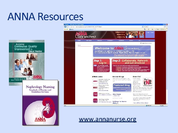 ANNA Resources www. annanurse. org 