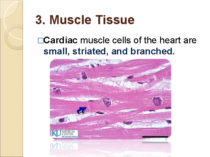 3. Muscle Tissue �Cardiac muscle cells of the heart are small, striated, and branched.