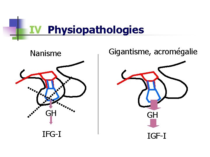 IV Physiopathologies Nanisme GH IFG-I Gigantisme, acromégalie GH IGF-I 