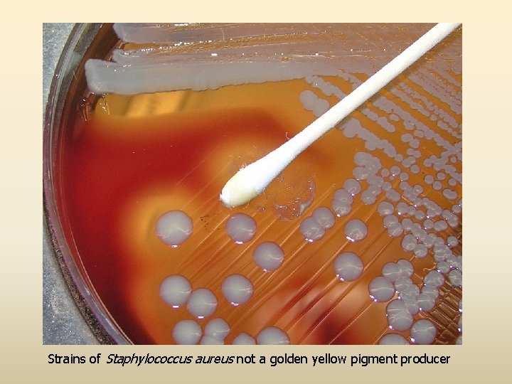 Strains of Staphylococcus aureus not a golden yellow pigment producer 