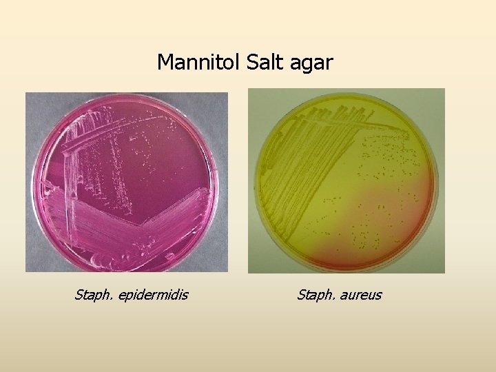 Mannitol Salt agar Staph. epidermidis Staph. aureus 