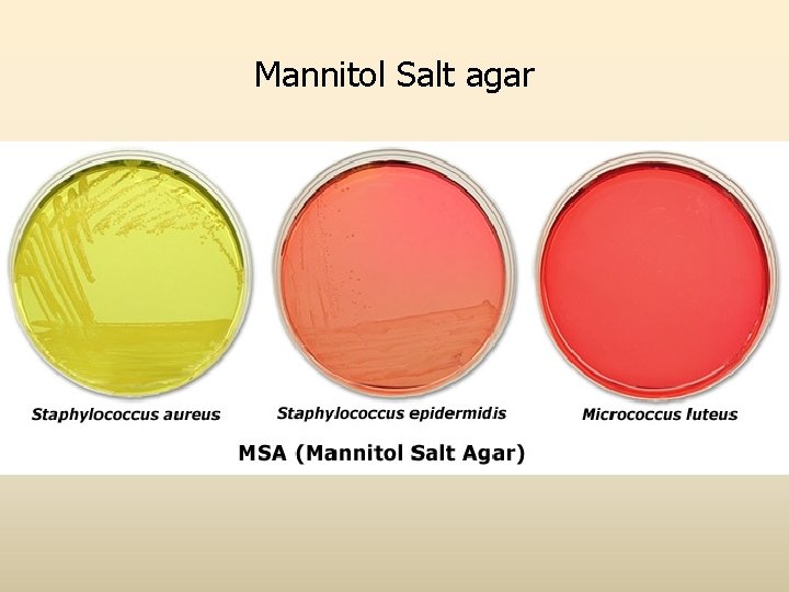 Mannitol Salt agar 