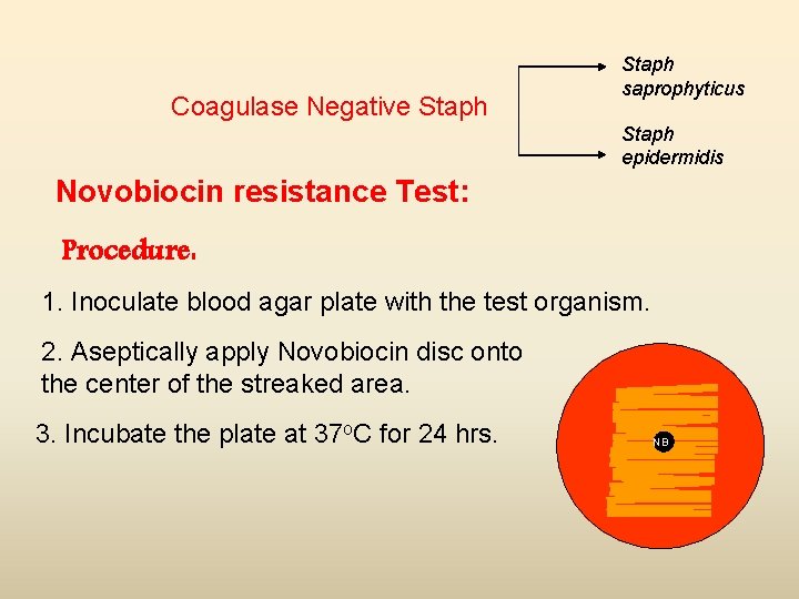 Coagulase Negative Staph saprophyticus Staph epidermidis Novobiocin resistance Test: Procedure: 1. Inoculate blood agar