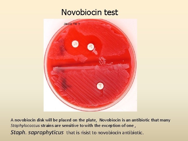 Novobiocin test A novobiocin disk will be placed on the plate, Novobiocin is an