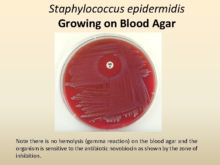 Staphylococcus epidermidis Growing on Blood Agar Note there is no hemolysis (gamma reaction) on