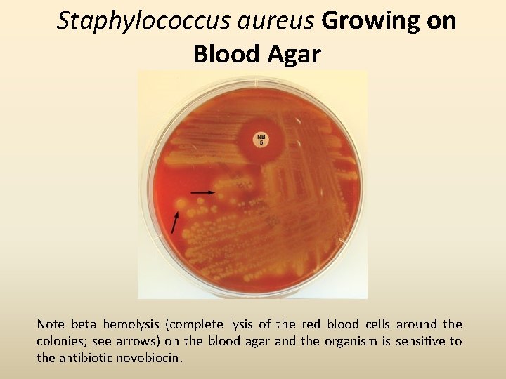 Staphylococcus aureus Growing on Blood Agar Note beta hemolysis (complete lysis of the red