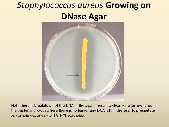 Staphylococcus aureus Growing on DNase Agar Note there is breakdown of the DNA in