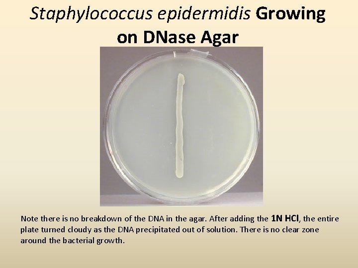 Staphylococcus epidermidis Growing on DNase Agar Note there is no breakdown of the DNA