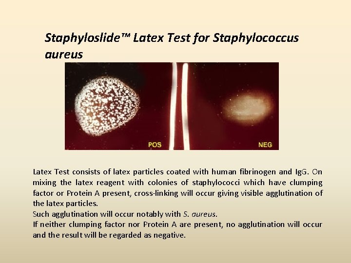 Staphyloslide™ Latex Test for Staphylococcus aureus Latex Test consists of latex particles coated with