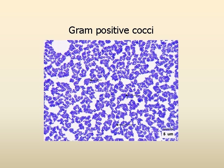 Gram positive cocci 