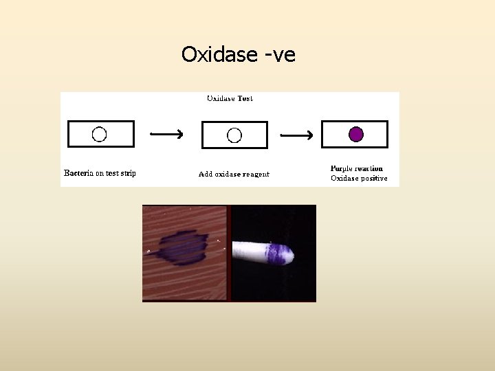 Oxidase -ve 