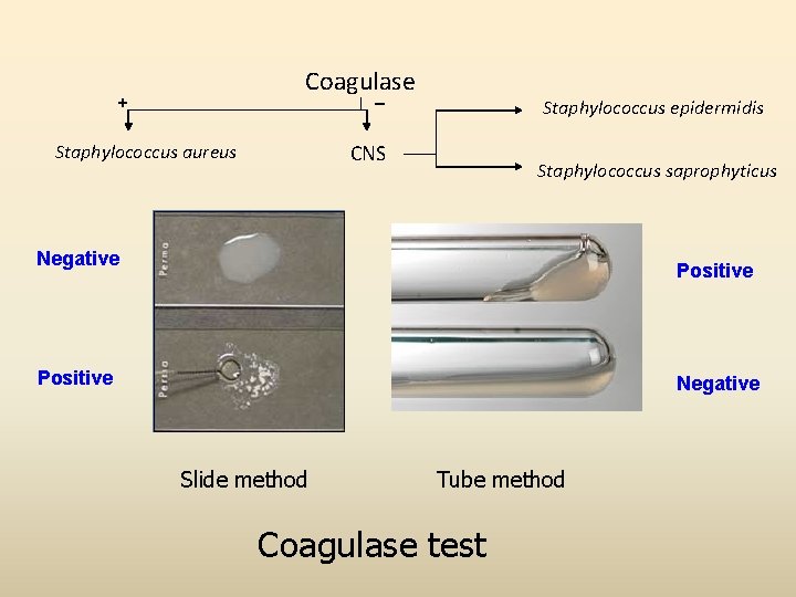 Coagulase _ + Staphylococcus epidermidis CNS Staphylococcus aureus Staphylococcus saprophyticus Negative Positive Negative Slide