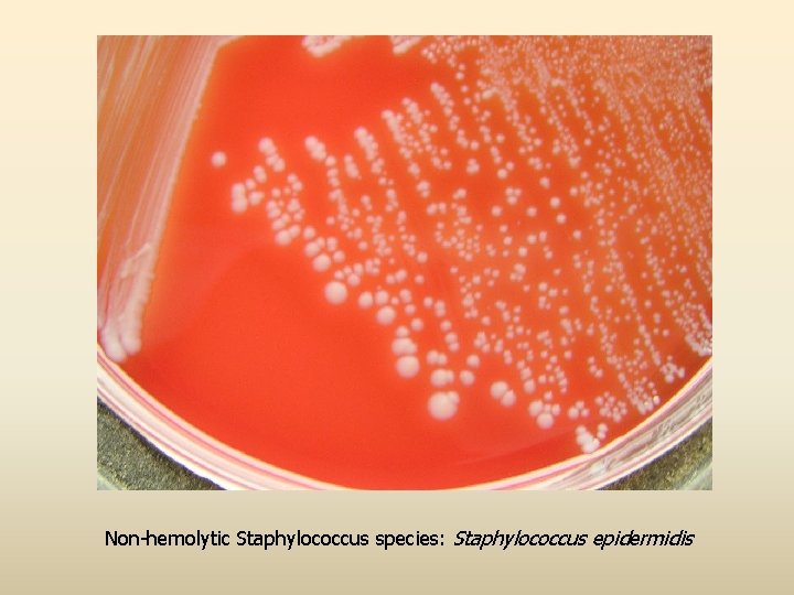 Non-hemolytic Staphylococcus species: Staphylococcus epidermidis 