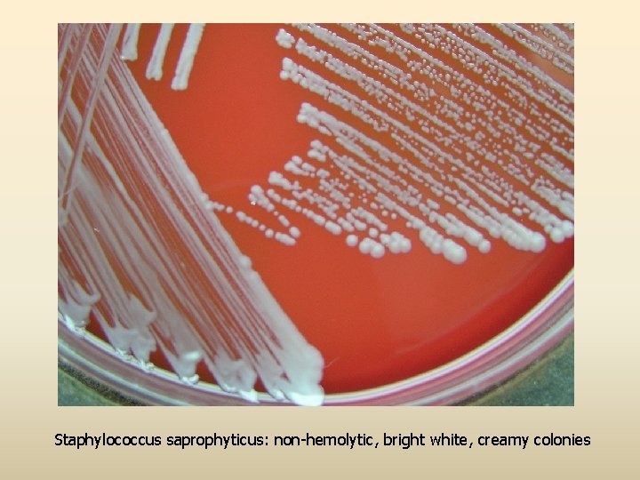 Staphylococcus saprophyticus: non-hemolytic, bright white, creamy colonies 