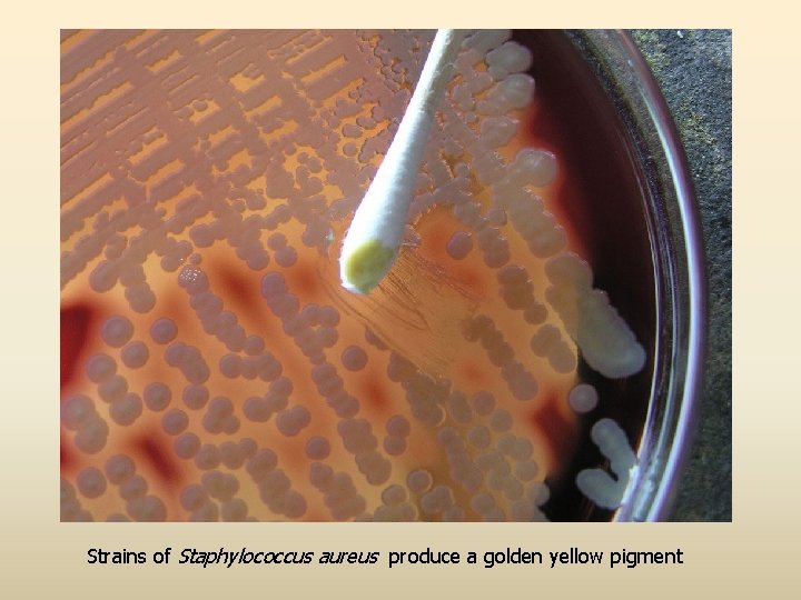 Strains of Staphylococcus aureus produce a golden yellow pigment 