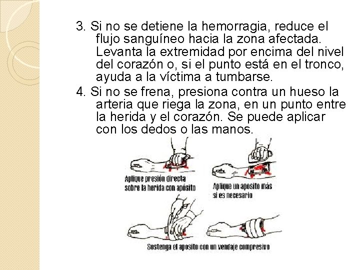 3. Si no se detiene la hemorragia, reduce el flujo sanguíneo hacia la zona