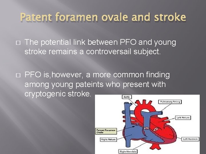 Patent foramen ovale and stroke � The potential link between PFO and young stroke