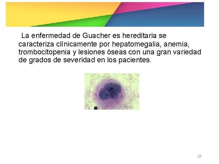 La enfermedad de Guacher es hereditaria se caracteriza clínicamente por hepatomegalia, anemia, trombocitopenia y