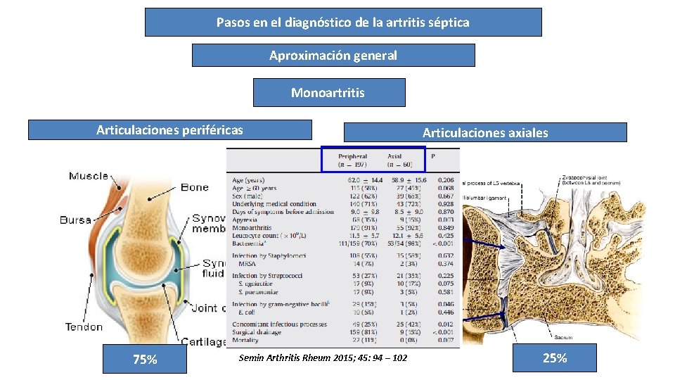 Pasos en el diagnóstico de la artritis séptica Aproximación general Monoartritis Articulaciones periféricas 75%