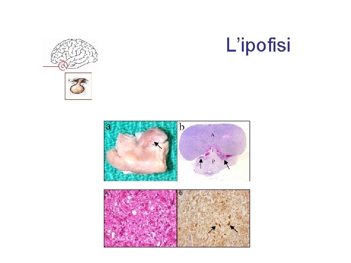 L’ipofisi 