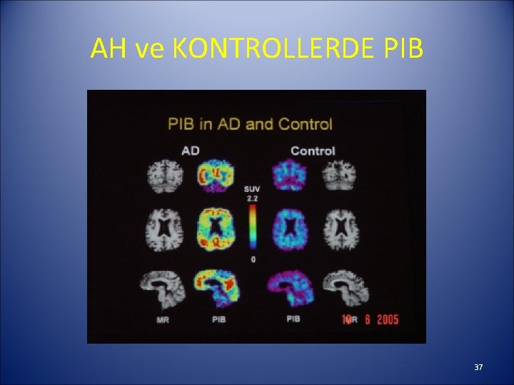 AH ve KONTROLLERDE PIB 37 