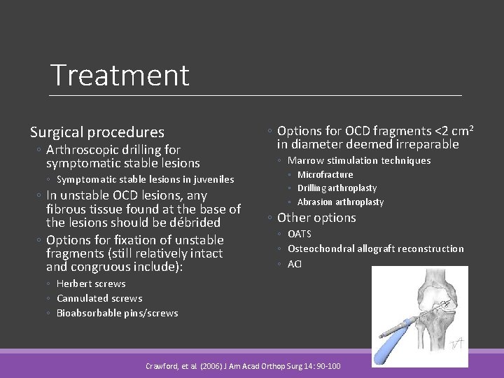 Treatment Surgical procedures ◦ Arthroscopic drilling for symptomatic stable lesions ◦ Symptomatic stable lesions