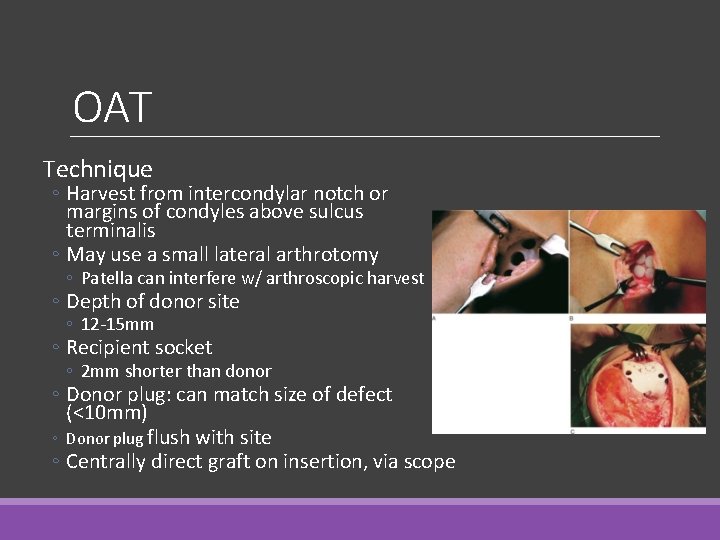 OAT Technique ◦ Harvest from intercondylar notch or margins of condyles above sulcus terminalis OAT Technique ◦ Harvest from intercondylar notch or margins of condyles above sulcus terminalis