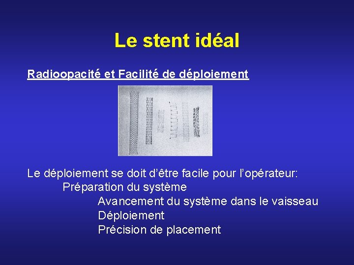 Le stent idéal Radioopacité et Facilité de déploiement Le déploiement se doit d’être facile Le stent idéal Radioopacité et Facilité de déploiement Le déploiement se doit d’être facile