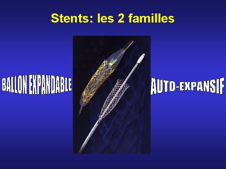 Stents: les 2 familles Stents: les 2 familles