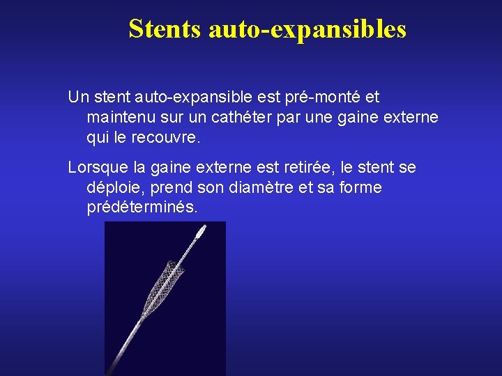 Stents auto-expansibles Un stent auto-expansible est pré-monté et maintenu sur un cathéter par une Stents auto-expansibles Un stent auto-expansible est pré-monté et maintenu sur un cathéter par une