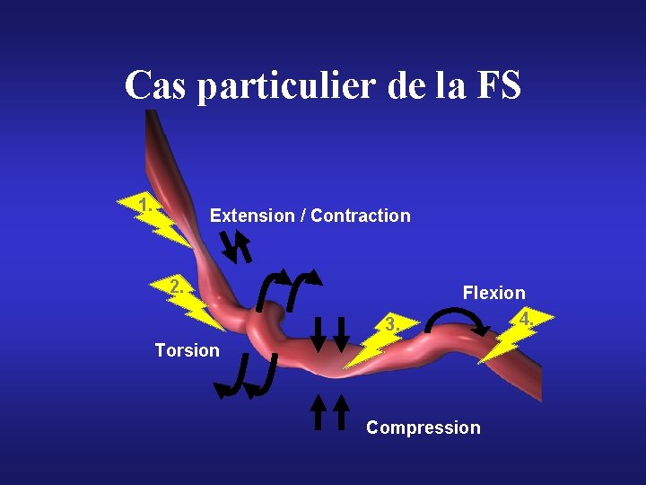 Cas particulier de la FS Extension / Contraction 1. 2. 3. Flexion 4. Torsion Cas particulier de la FS Extension / Contraction 1. 2. 3. Flexion 4. Torsion