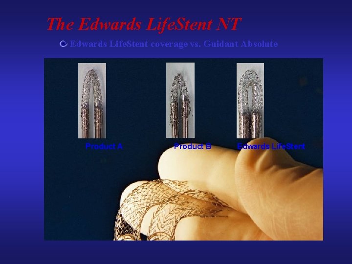 The Edwards Life. Stent NT Edwards Life. Stent coverage vs. Guidant Absolute Product A The Edwards Life. Stent NT Edwards Life. Stent coverage vs. Guidant Absolute Product A