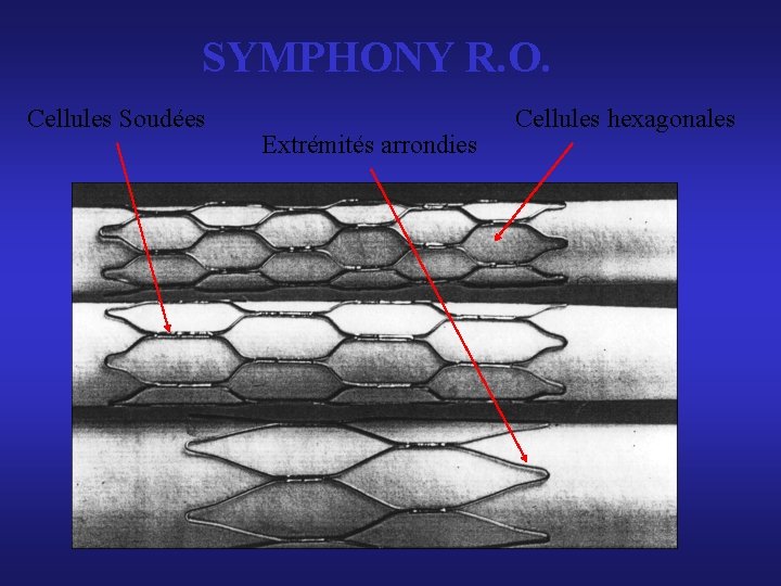 SYMPHONY R. O. Cellules Soudées Extrémités arrondies Cellules hexagonales SYMPHONY R. O. Cellules Soudées Extrémités arrondies Cellules hexagonales