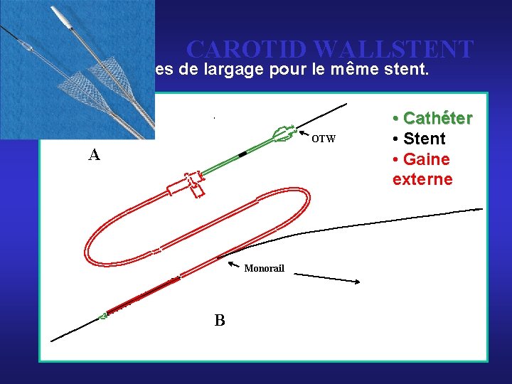 CAROTID WALLSTENT 2 systèmes de largage pour le même stent. OTW A Monorail B CAROTID WALLSTENT 2 systèmes de largage pour le même stent. OTW A Monorail B